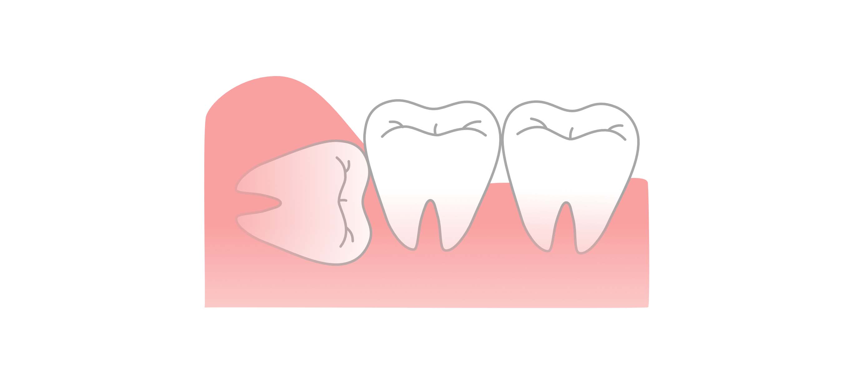 おおつ歯科こども歯科