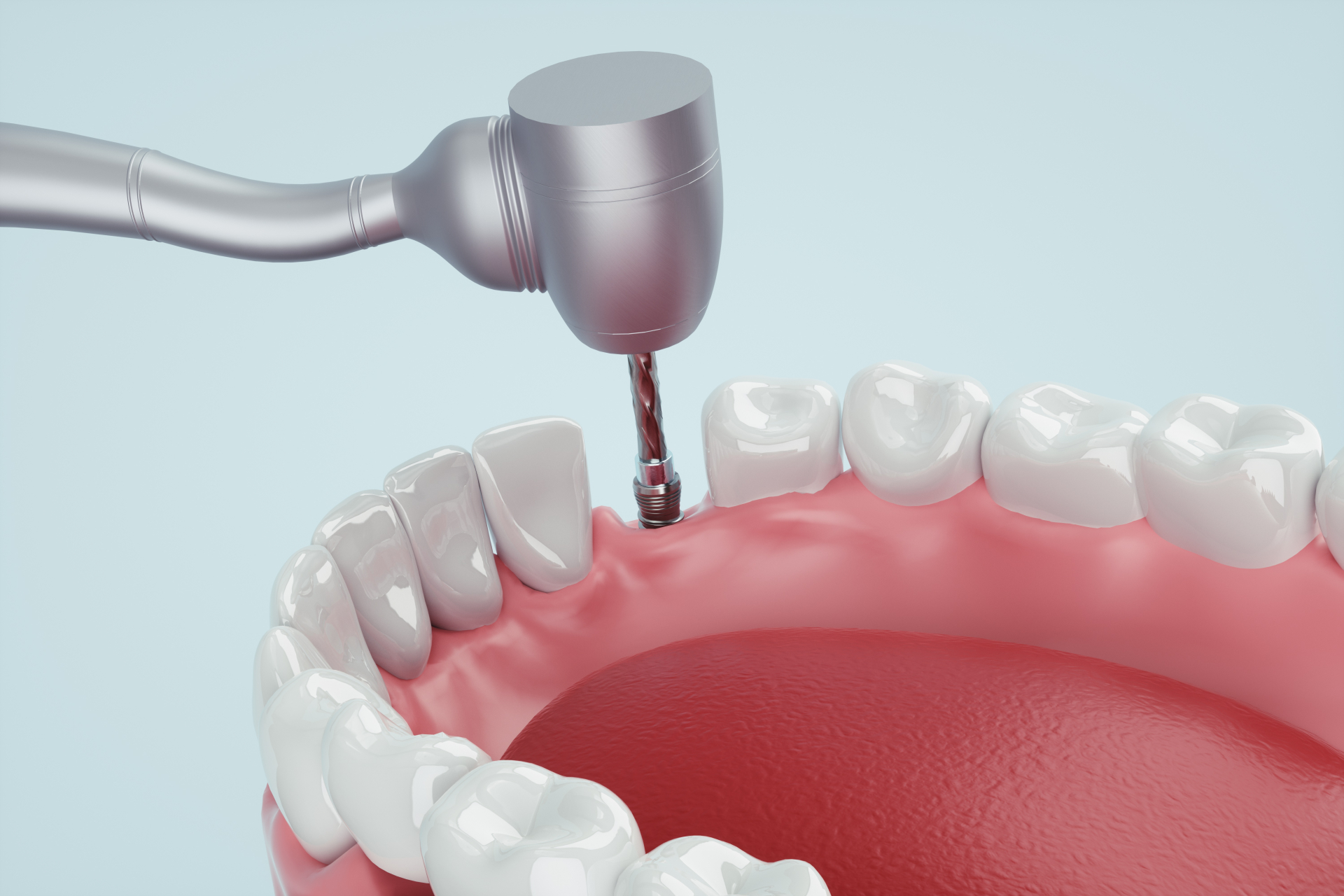 おおつ歯科こども歯科