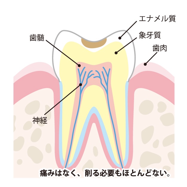 おおつ歯科こども歯科